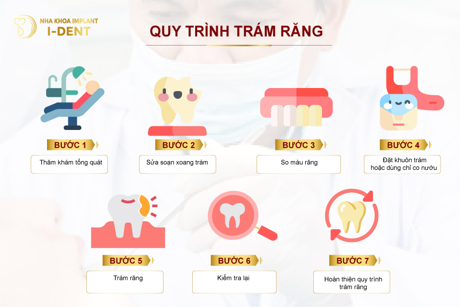 Các bước trám răng thẩm mỹ Các bước trám răng thẩm mỹ