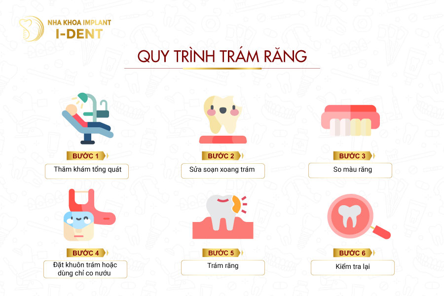 Quy trình trám răng (hàn răng) Quy trình trám răng (hàn răng)