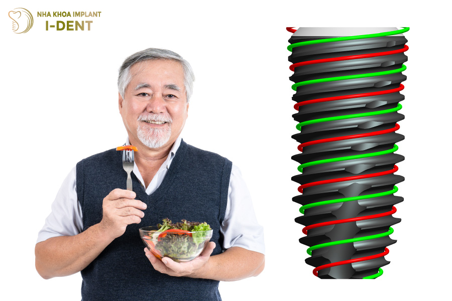 Răng Implant có thể ăn uống cứng chắc và thoải mái như răng thật Răng Implant có thể ăn uống cứng chắc và thoải mái như răng thật