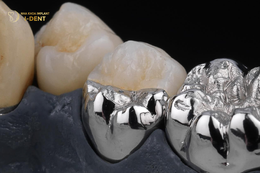 răng sứ Chrome Cobalt răng sứ Chrome Cobalt