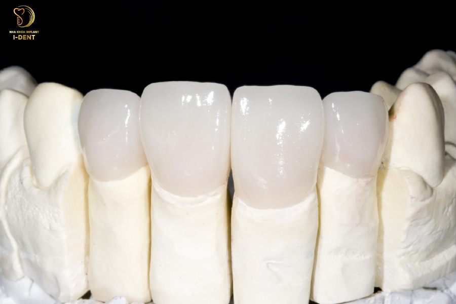 răng sứ zirconia có mấy loại