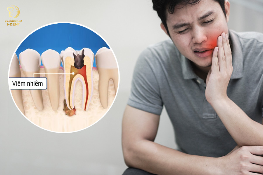 Xuất hiện lỗ đen và thường xuyên đau nhức cho thấy răng đã sâu nặng Xuất hiện lỗ đen và thường xuyên đau nhức cho thấy răng đã sâu nặng